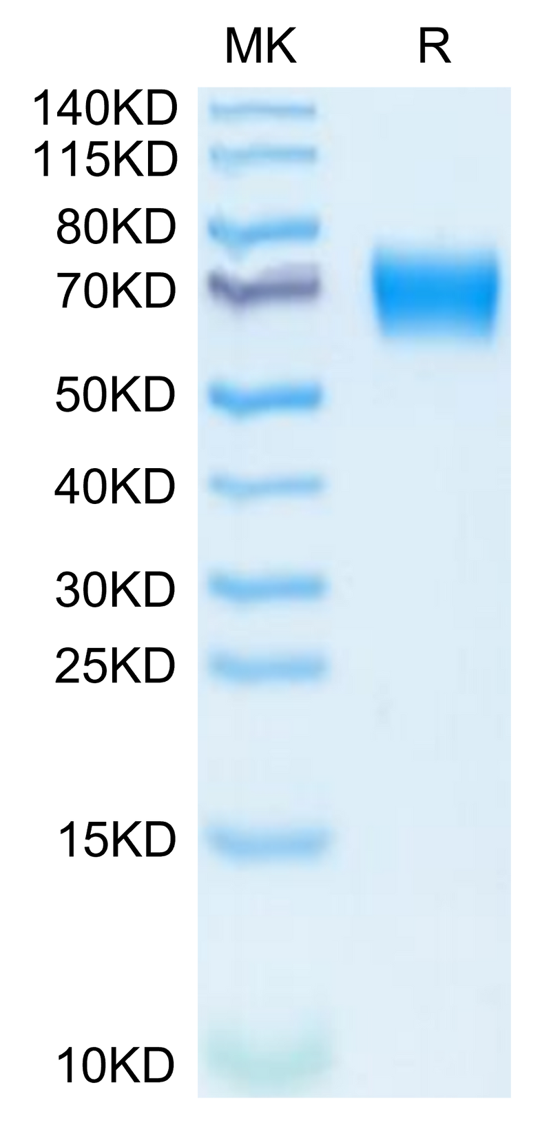 Mouse IL-18 R1 on Tris-Bis PAGE under reduced condition. The purity is greater than 95%.Recombinant Mouse IL-18 R1/CD218a Protein, Active