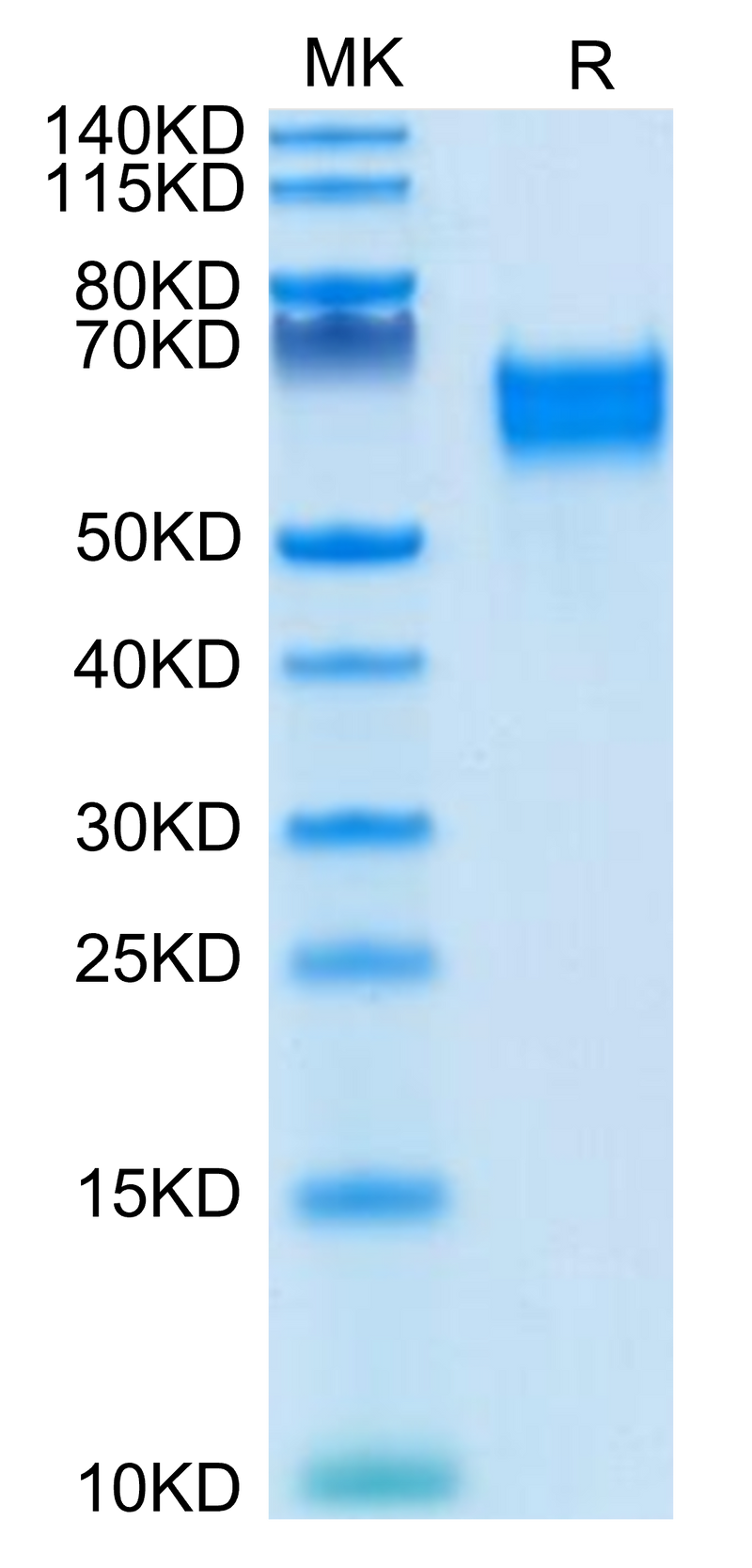 Biotinylated Human IL-18 R1 on Tris-Bis PAGE under reduced condition. The purity is greater than 95%.Biotinylated Human IL-18 R1/CD218a Protein, Active