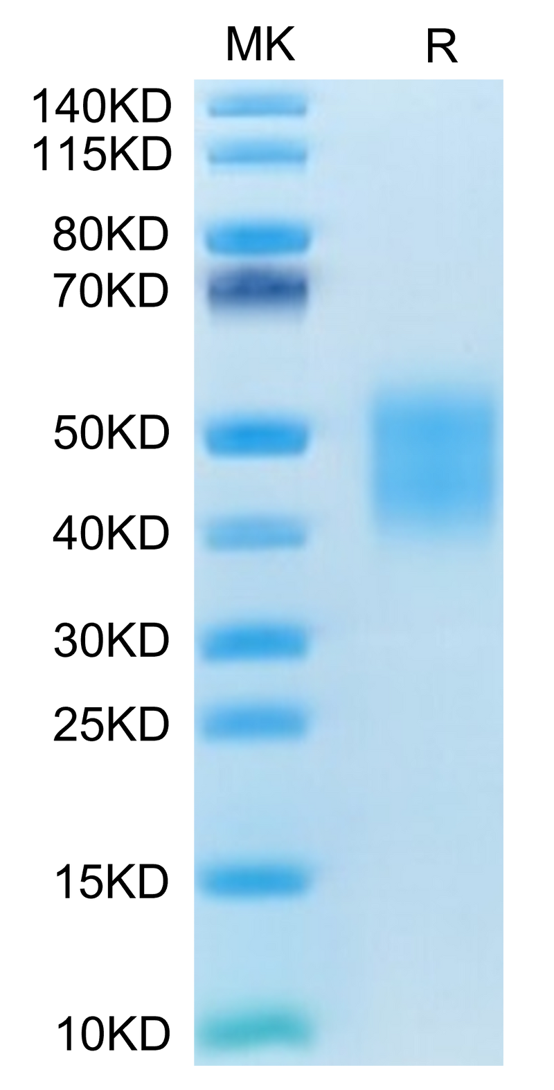 Canine CD28 on Tris-Bis PAGE under reduced condition. The purity is greater than 95%.Recombinant Canine CD28 Protein