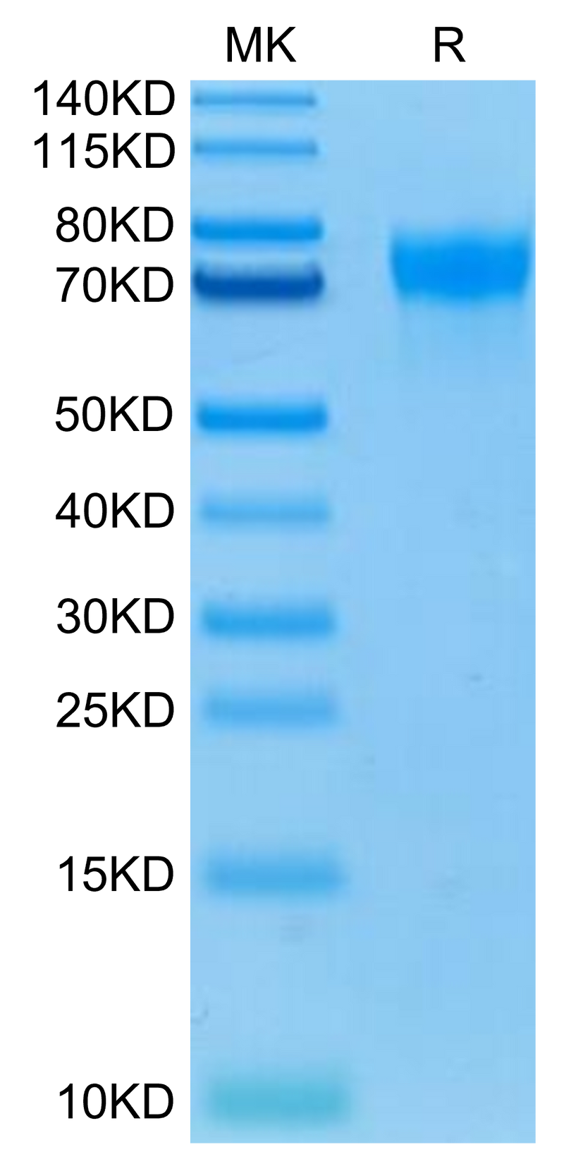 Biotinylated Human LILRA1 on Tris-Bis PAGE under reduced condition. The purity is greater than 95%.Biotinylated Human LILRA1/CD85i/LIR-6 Protein