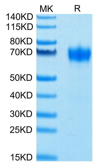 Biotinylated Human GM-CSF R alpha on Tris-Bis PAGE under reduced conditions. The purity is greater than 95%.Biotinylated Human GM-CSF R alpha Protein, Active