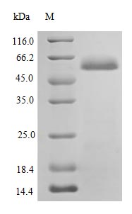 Image for Recombinant Human Protein Disulfide-Isomerase Protein (P4HB) Protein (His), Active