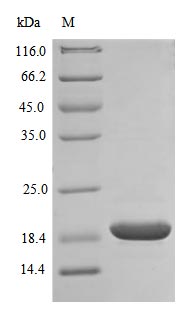 Recombinant Human Superoxide Dismutase [Cu-Zn] (SOD1) Protein (His), ActiveRecombinant Human Superoxide Dismutase [Cu-Zn] (SOD1) Protein (His), Active