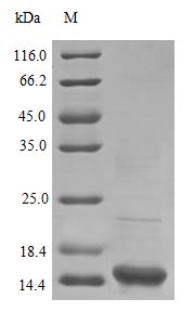 Image for Recombinant Human Superoxide Dismutase [Cu-Zn] Protein (SOD1)