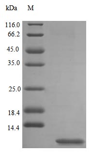 Image for Recombinant Rat Uteroglobin Protein (SCGB1A1), Active