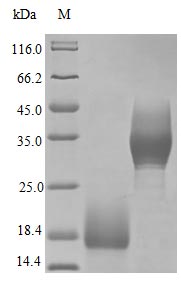 Image for Recombinant Human Trefoil Factor 3 Protein (TFF3), Active