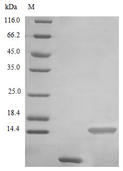 Image for Recombinant Human Uteroglobin Protein (SCGB1A1), Active
