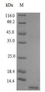 Image for Recombinant Human Stromal Cell-Derived Factor 1 Protein (CXCL12), Active