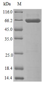 Image for Recombinant Human Epo-Alpha/Fc Chimera Protein (EPO) Protein (hFc), Active
