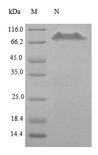 Recombinant Human Tumor Necrosis Factor Receptor Superfamily Member 11B Protein (TNFRSF11B) Protein (hFc), ActiveRecombinant Human Tumor Necrosis Factor Receptor Superfamily Member 11B Protein (TNFRSF11B) Protein (hFc), Active