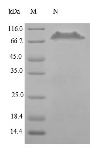Recombinant Human Tumor Necrosis Factor Receptor Superfamily Member 11B Protein (TNFRSF11B) Protein (hFc), Active