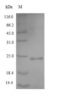 Image for Recombinant Human Noggin Protein (NOG), Active