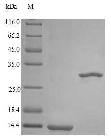 Image for Recombinant Rhesus Macaque Interleukin-5 Protein (IL5), Active