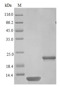 Image for Recombinant Mouse Interleukin-5 Protein (IL5), Active