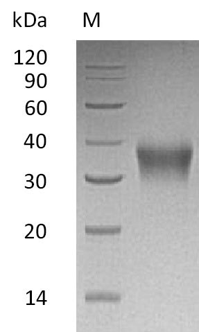 Greater than 95% as determined by SDS-PAGE.Recombinant Human Erythropoietin (EPO) Protein (His), Active