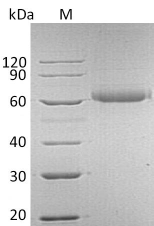 Greater than 95% as determined by SDS-PAGE.Recombinant Human Fibroblast Growth Factor Receptor-Like 1 (FGFRL1) Protein (His), Active