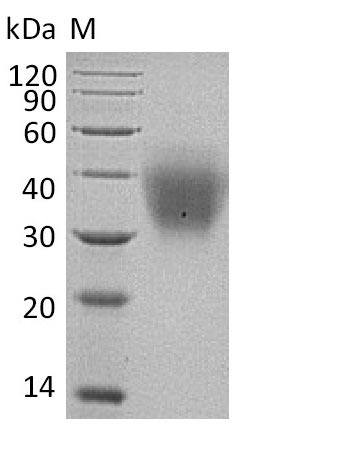 Greater than 95% as determined by SDS-PAGE.Recombinant Human Kit Ligand (KITLG) Protein (His), Active