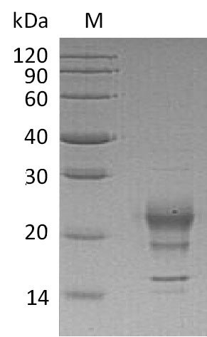 Greater than 90% as determined by SDS-PAGE.Recombinant Human Interferon Gamma (IFNG), Active