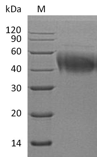 Greater than 95% as determined by SDS-PAGE.Recombinant Human Interleukin-4 Receptor Subunit Alpha (IL4R) Protein (His), Active