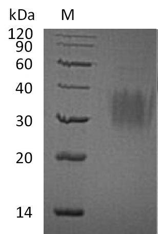 Greater than 95% as determined by SDS-PAGE.Recombinant Human Interleukin-9 (IL9) Protein (His), Active