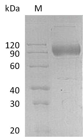 Greater than 90% as determined by SDS-PAGE.Recombinant Human Interleukin-17 Receptor A (IL17RA) Protein (hFc), Active