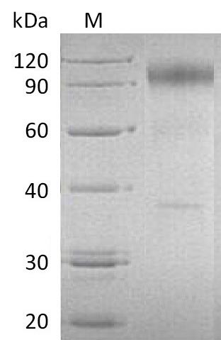 Greater than 90% as determined by SDS-PAGE.Recombinant Human Interleukin-23 Receptor (IL23R) Protein (hFc), Active