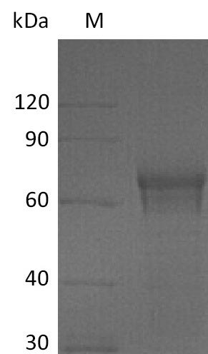 Greater than 95% as determined by SDS-PAGE.Recombinant Human Interleukin-15 Receptor Subunit Alpha (IL15RA) Protein (hFc), Active