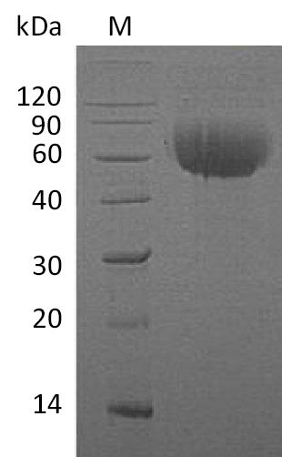 Greater than 95% as determined by SDS-PAGE.Recombinant Human Interleukin-13 Receptor Subunit Alpha-1 (IL13RA1) Protein (His), Active