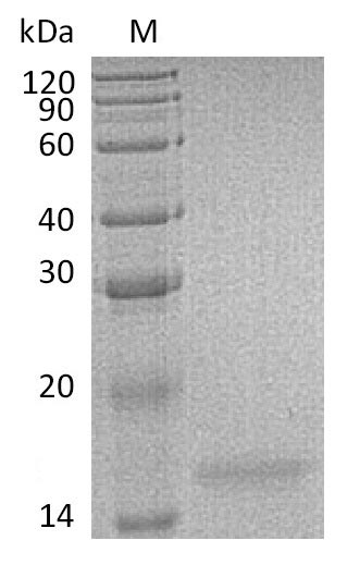 Greater than 95% as determined by SDS-PAGE.Recombinant Human Interleukin-17F (IL17F), Active