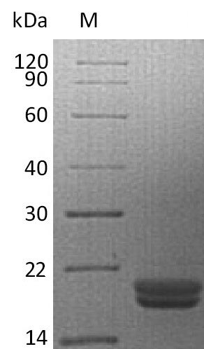 Greater than 95% as determined by SDS-PAGE.Recombinant Human Pro-Interleukin-16 (IL16), Active