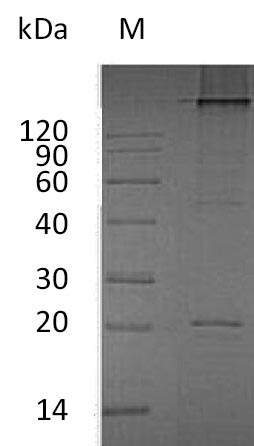 Greater than 90% as determined by SDS-PAGE.Recombinant Human Tumor Necrosis Factor Ligand Superfamily Member 11 (TNFSF11) Protein (His), Active