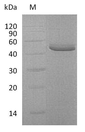Greater than 95% as determined by SDS-PAGE.Recombinant Human Tumor Necrosis Factor Receptor Superfamily Member 10B (TNFRSF10B) Protein (His-hFc), Active
