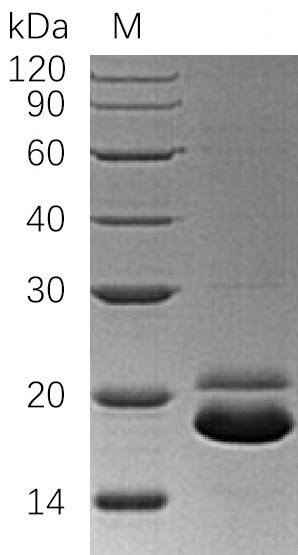 Greater than 95% as determined by SDS-PAGE.Recombinant Human Tumor Necrosis Factor Receptor Superfamily Member 10B (TNFRSF10B) Protein (His), Active