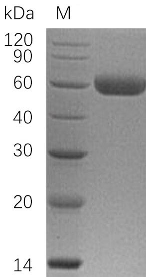 Greater than 95% as determined by SDS-PAGE.Recombinant Human Tumor Necrosis Factor Receptor Superfamily Member 11B (TNFRSF11B) Protein (His), Active