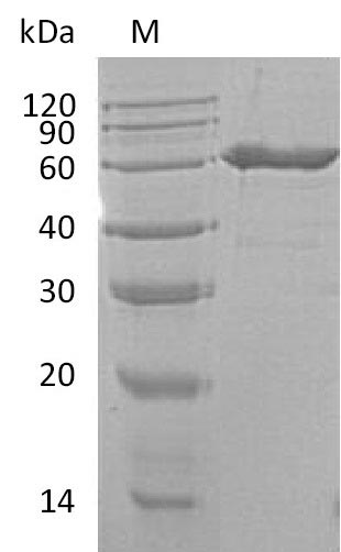 Greater than 95% as determined by SDS-PAGE.Recombinant Mouse 5'-Nucleotidase (NT5E) Protein (His), Active