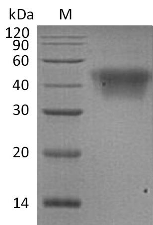 Greater than 95% as determined by SDS-PAGE.Recombinant Human Low Affinity Immunoglobulin Gamma Fc Region Receptor Iii-A (FCGR3A) Protein (His), Active