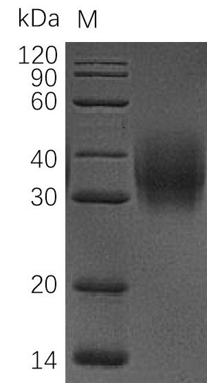 Greater than 95% as determined by SDS-PAGE.Recombinant Human Leukocyte Surface Antigen Cd47 (CD47) Protein (His), Active