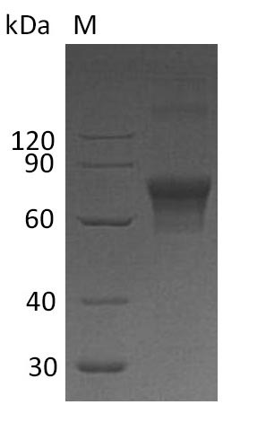 Greater than 90% as determined by SDS-PAGE.Recombinant Human Hepatitis A Virus Cellular Receptor 2 (HAVCR2) Protein (His-hFc), Active