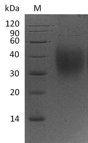 Greater than 95% as determined by SDS-PAGE.