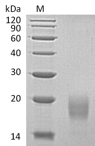 Greater than 95% as determined by SDS-PAGE.Recombinant Human Activin Receptor Type-1B (ACVR1B) Protein (His), Active