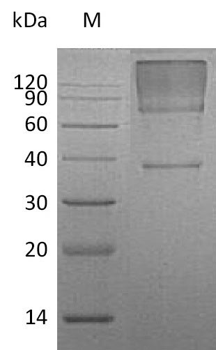 Greater than 90% as determined by SDS-PAGE.Recombinant Human Glypican-3 (GPC3) Protein (His), Active