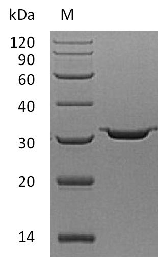 Greater than 95% as determined by SDS-PAGE.Recombinant Human Carbonic Anhydrase 7 (CA7) Protein (His), Active
