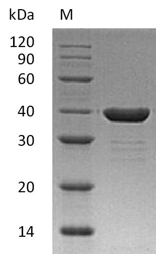 Greater than 95% as determined by SDS-PAGE.Recombinant Human Carbonic Anhydrase-Related Protein (CA8) Protein (His), Active