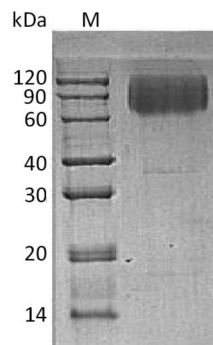 Greater than 95% as determined by SDS-PAGE.Recombinant Human Lysosome-Associated Membrane Glycoprotein 2 (LAMP2) Protein (His), Active