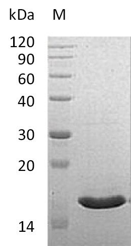 Greater than 90% as determined by SDS-PAGE.Recombinant Human Vesicle-Associated Membrane Protein-Associated Protein B/C (VAPB) Protein (His), Active