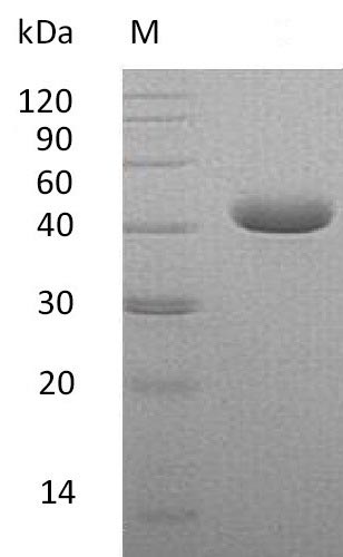 Greater than 95% as determined by SDS-PAGE.Recombinant Human Nectin-4 (NECTIN4) Protein (His), Active