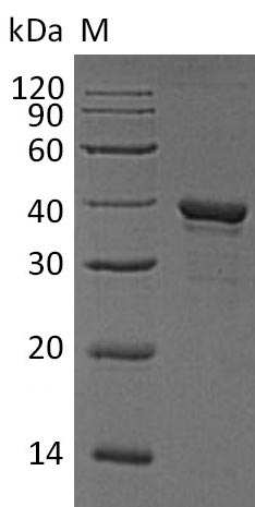 Greater than 90% as determined by SDS-PAGE.Recombinant Human Arginase-1 (ARG1) Protein (His), Active