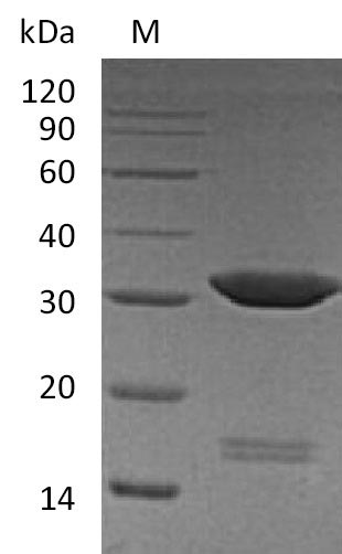 Greater than 95% as determined by SDS-PAGE.Recombinant Human Carbonic Anhydrase 4 (CA4) Protein (His), Active
