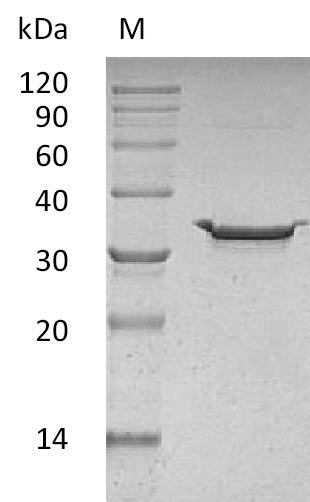 Greater than 95% as determined by SDS-PAGE.Recombinant Human Carbonic Anhydrase 5B, Mitochondrial (CA5B) Protein (His), Active