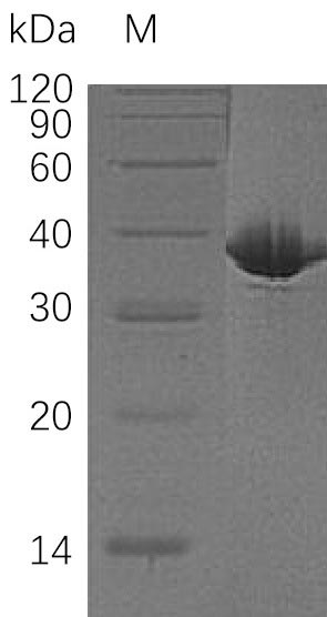 Greater than 95% as determined by SDS-PAGE.Recombinant Human Malate Dehydrogenase, Cytoplasmic (MDH1) Protein (His), Active